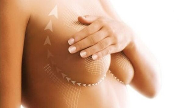 sollevamento della sutura per l'aumento del seno