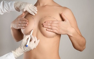 metodi di aumento del seno con la chirurgia