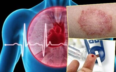 Controindicazioni per lipolifting