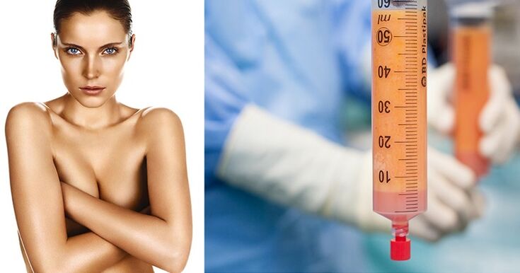 lipofilling come metodo di ingrandimento del seno