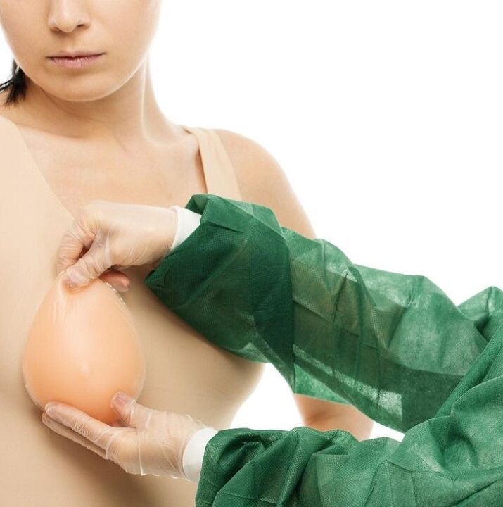protesi per l'ingrandimento del seno